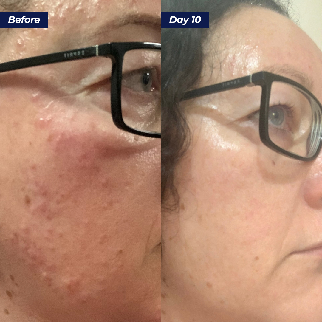 Abundance Face & Body Mask