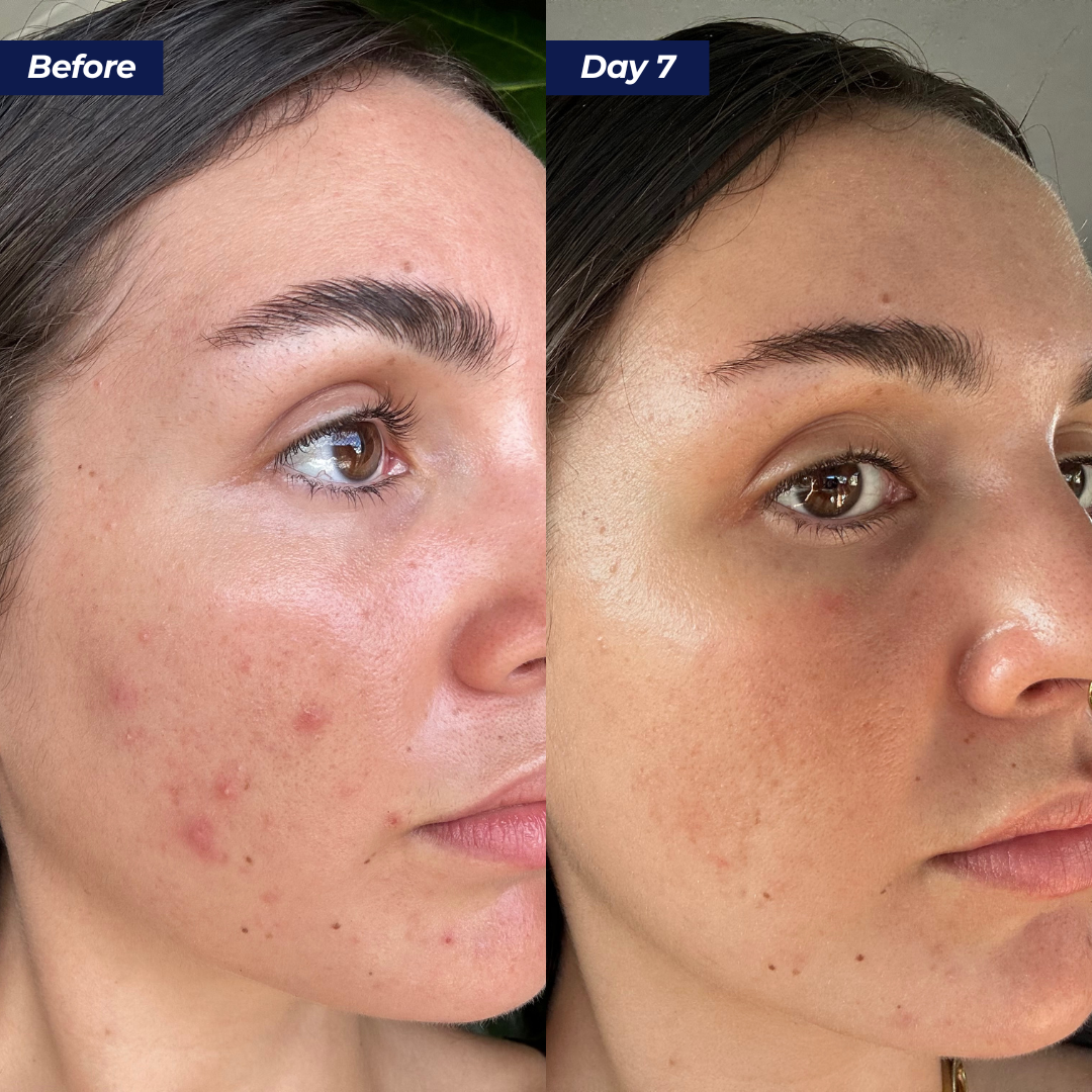 Abundance Face & Body Mask