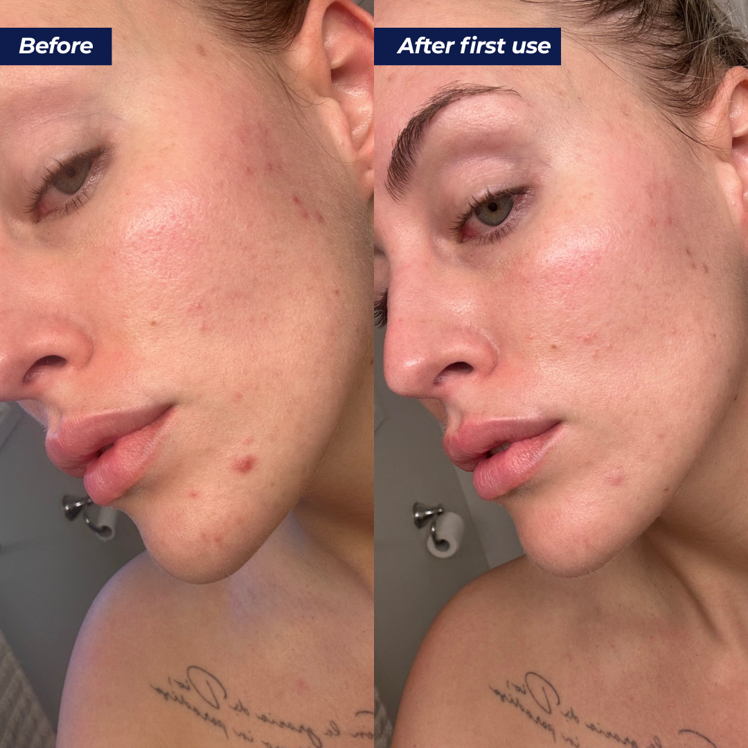 Abundance Face & Body Mask