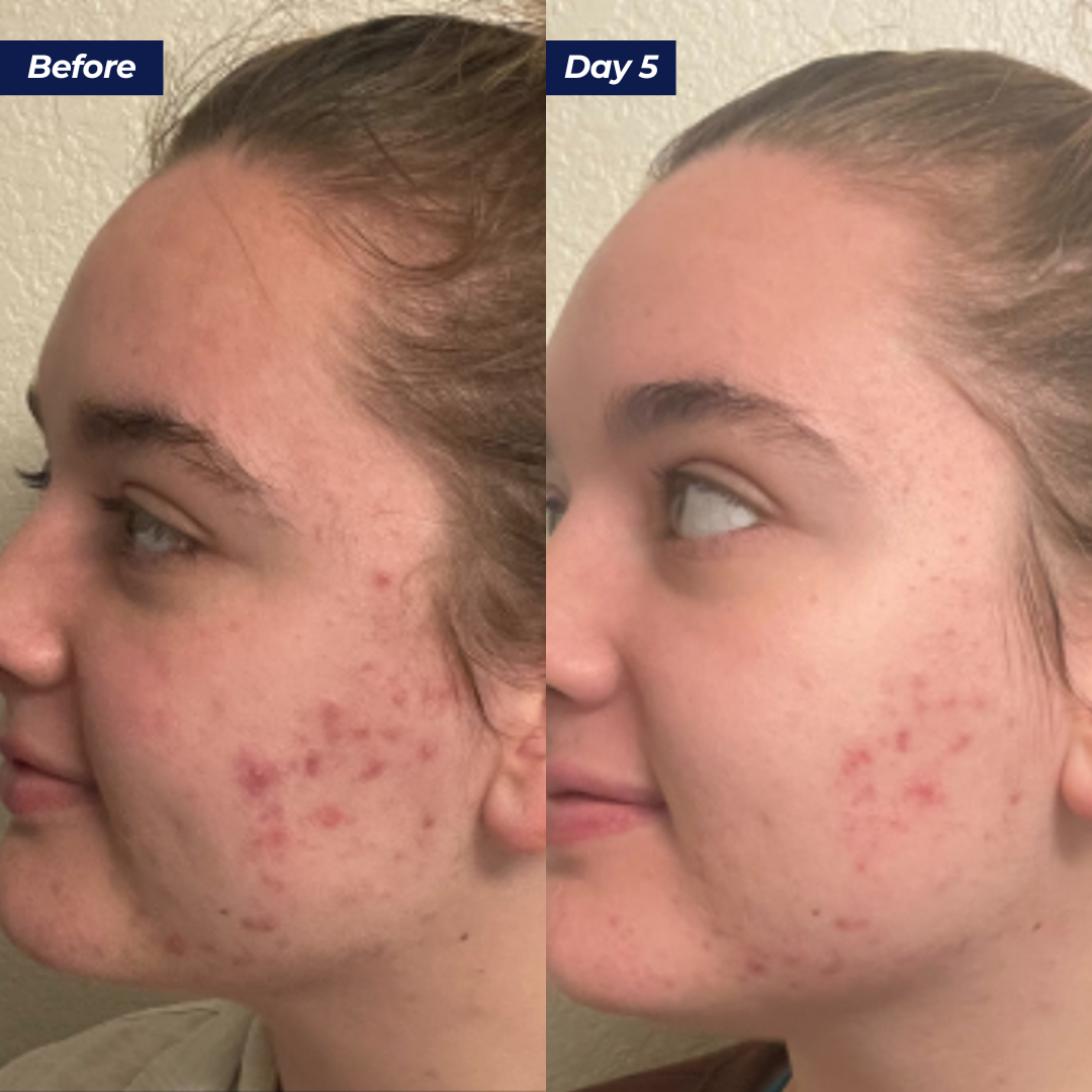 Abundance Face & Body Mask